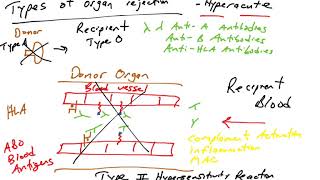 Transplantation and Graft Rejection Immunology Lecture 09 [upl. by Ullman850]