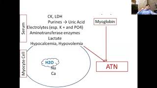 What is rhabdomyolysis [upl. by Blanche666]