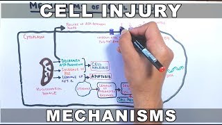 Lecture 33 Ischemia reperfusion injury [upl. by Bendix]