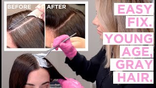 Young Age Gray Hair  An Easy Fix [upl. by Sirraf]