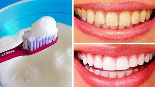 10 Natural Ways to Whiten Teeth at Home [upl. by Rayham]