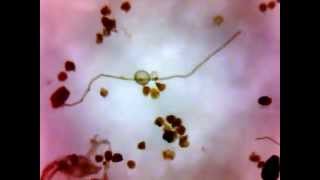 Isolation of arbuscular mycorrhizal spores [upl. by Zuckerman]