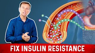 7 Things That Boost Insulin Sensitivity or Reverse Insulin Resistance  Dr Berg [upl. by Fenelia]