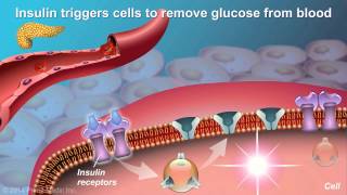 Understanding Type 2 Diabetes [upl. by Aros]