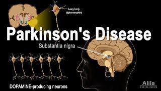 Pharmacology  Parkinsons Disease [upl. by Yetta661]