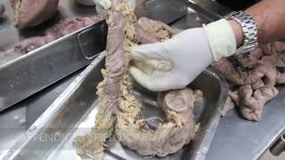 Anatomy Dissection of Large amp Small Intestine [upl. by Eornom]