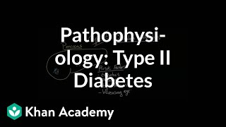 Type 2 Diabetes Signs amp Symptoms amp Why They Occur amp Associated Conditions [upl. by Conway]