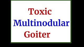 Toxic Multinodular Goiter [upl. by Korella546]