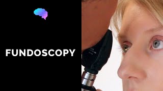 Fundoscopy Ophthalmoscopy  OSCE Guide  UKMLA  CPSA  PLAB 2 [upl. by Nalo346]