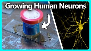 Growing Human Neurons on a Home Made Electrode Array [upl. by Garfinkel]