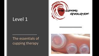 What is Cupping  Myofascial Decompression Cupping  EMH Physical Therapy [upl. by Araid170]