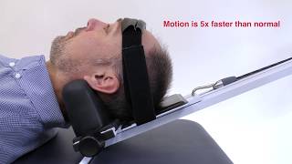 Neck Decompression Machine  Cervical Mechanical Traction [upl. by Sissie]