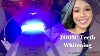 ZOOM Professional Teeth Whitening  Dentist Recommended  My Experience [upl. by Ripleigh870]