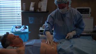 Vaser Liposuction  SmartLipo [upl. by Pearline958]