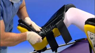 Allen Medical  Allen Stirrups  Instructional Video [upl. by Streeto]