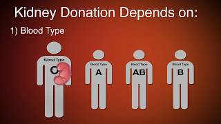 What Is a Kidney Transplant [upl. by Irtemed641]