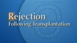 Rejection Following Transplantation [upl. by Atikahs]