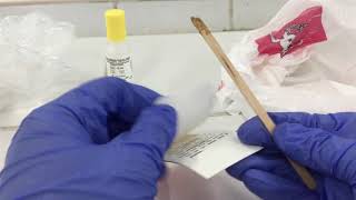 MT Laboratory Procedures  MT 35 Fecal Occult Blood Test HemaScreen [upl. by Ynohtnaluap]