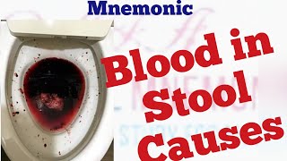 Causes of blood in stool Mnemonic [upl. by Brooks]