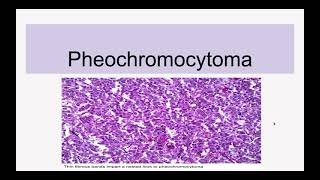 Pheochromocytoma [upl. by Presber]