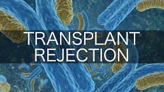 Transplant Rejection [upl. by Pheni]