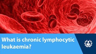 What is chronic lymphocytic leukaemia [upl. by Alakam960]