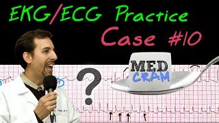 12 Lead ECG Practice Strip Interpretation  EKG Case 10 [upl. by Ulla]