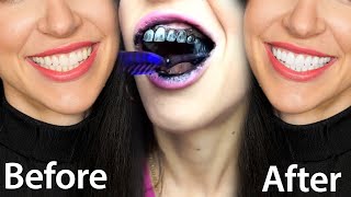 Fastest Way To Whiten Teeth At Home What REALLY Works [upl. by Citarella186]