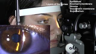 Ophthalmic Skills Series Part 15 [upl. by Killoran795]